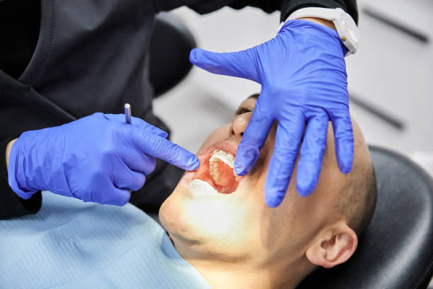 Best Emergency Dentist for Lost Fillings or Crowns in Westphalia, MD